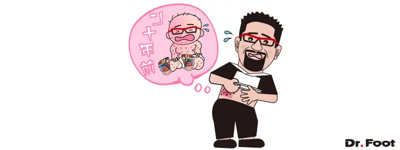 第22回帯状疱疹